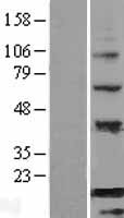 BATF Protein - Western validation with an anti-DDK antibody * L: Control HEK293 lysate R: Over-expression lysate