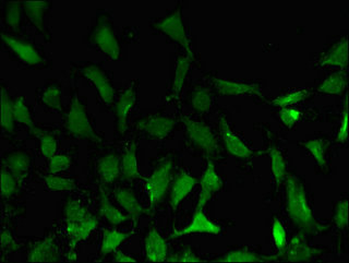 BATF3 Antibody - Immunofluorescent analysis of Hela cells using BATF3 Antibody at dilution of 1:100 and Alexa Fluor 488-congugated AffiniPure Goat Anti-Rabbit IgG(H+L)