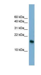BATF3 Antibody - BATF3 antibody Western blot of HT1080 cell lysate. This image was taken for the unconjugated form of this product. Other forms have not been tested.