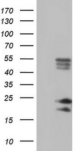 BAX Antibody - HEK293T cells were transfected with the pCMV6-ENTRY control (Left lane) or pCMV6-ENTRY BAX (Right lane) cDNA for 48 hrs and lysed. Equivalent amounts of cell lysates (5 ug per lane) were separated by SDS-PAGE and immunoblotted with Rabbit polyclonal anti-BAX antibody at 1:2000 dilution.