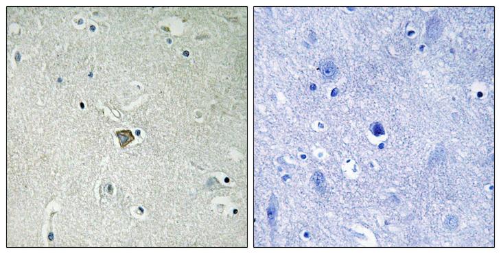 BAX Antibody - Immunohistochemistry analysis of paraffin-embedded human brain tissue, using Bax Antibody. The picture on the right is blocked with the synthesized peptide.