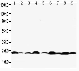 BAX Antibody - Bax antibody Western blot. Lane 1: Rat Testis Tissue Lysate. Lane 2: Rat Kidney Tissue Lysate. Lane 3: Rat Brain Tissue Lysate. Lane 4: Rat Ovary Tissue Lysate. Lane 5: HELA Cell Lysate. Lane 6: MM231 Cell Lysate. Lane 7: A549 Cell Lysate. Lane 8: JURKAT Cell Lysate. Lane 9: Human Placenta Tissue Lysate.