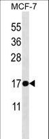 BAX Antibody - BAX Antibody western blot of MCF-7 cell line lysates (35 ug/lane). The BAX antibody detected the BAX protein (arrow).