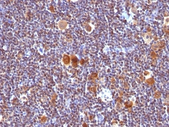 BAX Antibody - Formalin-fixed, paraffin-embedded human Hodgkin's lymphoma stained with anti-Bax antibody (Clone SPM336).  This image was taken for the unmodified form of this product. Other forms have not been tested.