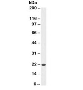 BAX Antibody - Western blot testing of HeLa cell lysate with anti-Bax antibody (clone SPM336). Observed molecular weight ~21kDa.