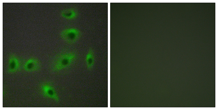 BAX Antibody - Immunofluorescence analysis of HUVEC cells, using BAX Antibody. The picture on the right is blocked with the synthesized peptide.
