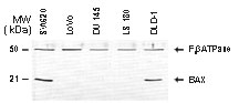 BAX Antibody - Western blot of BAX in colon tumor cell lines using Polyclonal Antibody to Bax. Bax is detected in the SW620 and DLD-1 cell lines. However, Bax was not detected in the cell lines (LoVo, DU145, and LS180) known to have frameshift mutations in Bax (Rampino et al. 1997). An antibody to F1