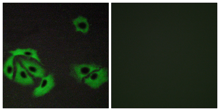BAX Antibody - Immunofluorescence analysis of A549 cells, using BAX Antibody. The picture on the right is blocked with the synthesized peptide.