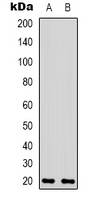 BAX Antibody - Western blot analysis of BAX expression in L929 (A); HepG2 (B) whole cell lysates.