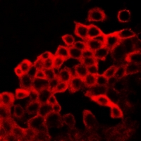BAX Antibody - Immunofluorescent analysis of BAX staining in LOVO cells. Formalin-fixed cells were permeabilized with 0.1% Triton X-100 in TBS for 5-10 minutes and blocked with 3% BSA-PBS for 30 minutes at room temperature. Cells were probed with the primary antibody in 3% BSA-PBS and incubated overnight at 4 deg C in a humidified chamber. Cells were washed with PBST and incubated with a DyLight 594-conjugated secondary antibody (red) in PBS at room temperature in the dark. DAPI was used to stain the cell nuclei (blue).