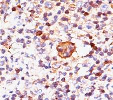 BAX Antibody - Bax antibody immunohistochemistry.  This image was taken for the unmodified form of this product. Other forms have not been tested.