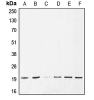 BAX Antibody - Western blot analysis of BAX expression in HeLa (A); A549 (B); A375 (C); Jurkat (D); HepG2 (E); PC12 (F) whole cell lysates.