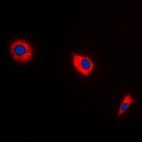 BAX Antibody - Immunofluorescent analysis of BAX staining in A549 cells. Formalin-fixed cells were permeabilized with 0.1% Triton X-100 in TBS for 5-10 minutes and blocked with 3% BSA-PBS for 30 minutes at room temperature. Cells were probed with the primary antibody in 3% BSA-PBS and incubated overnight at 4 C in a humidified chamber. Cells were washed with PBST and incubated with a DyLight 594-conjugated secondary antibody (red) in PBS at room temperature in the dark. DAPI was used to stain the cell nuclei (blue).