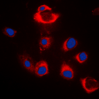 BAX Antibody - Immunofluorescent analysis of BAX staining in HeLa cells. Formalin-fixed cells were permeabilized with 0.1% Triton X-100 in TBS for 5-10 minutes and blocked with 3% BSA-PBS for 30 minutes at room temperature. Cells were probed with the primary antibody in 3% BSA-PBS and incubated overnight at 4 C in a humidified chamber. Cells were washed with PBST and incubated with a DyLight 594-conjugated secondary antibody (red) in PBS at room temperature in the dark. DAPI was used to stain the cell nuclei (blue).