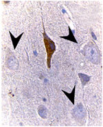 BAX Antibody - Formalin-fixed paraffin embedded section of dog ischemic brain cortex stained for Bax expression using Polyclonal Antibody to Bax at 1:2000. At 2 hr post ischemia, Bax staining was seen in the dying neuron that had morphological features of apoptosis. In contrast, morphologically normal appearing neurons lacked Bax staining (arrowheads). Hematoxylin-Eosin counterstain.