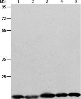 BAX Antibody - Western blot analysis of Human brain malignant glioma tissue, MCF7, Raji, Lovo and 293T cell, using BAX Polyclonal Antibody at dilution of 1:426.