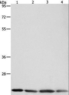 BAX Antibody - Western blot analysis of Human brain malignant glioma tissue, MCF7, Raji and Lovo cell, using BAX Polyclonal Antibody at dilution of 1:300.
