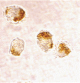 BAX Antibody - Immunocytochemistry staining of HL-60 cells using Bax at 2 ug/ml.