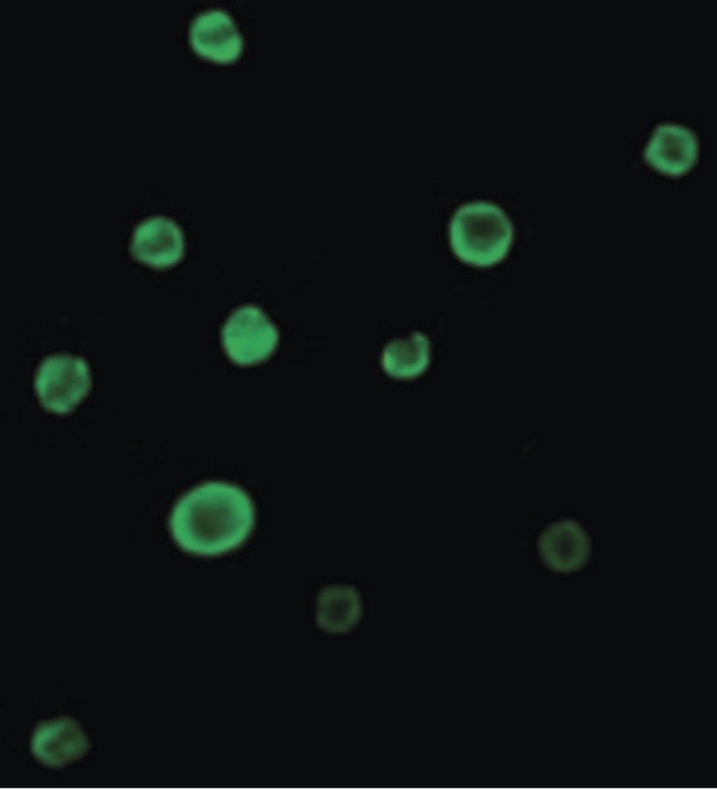 BAX Antibody - Immunofluorescence of Bax in HL60 cells with Bax antibody at 2 ug/ml.