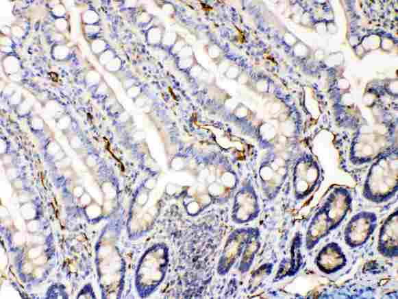 BAX Antibody - Bax was detected in paraffin-embedded sections of rat intestine tissues using rabbit anti- Bax Antigen Affinity purified polyclonal antibody