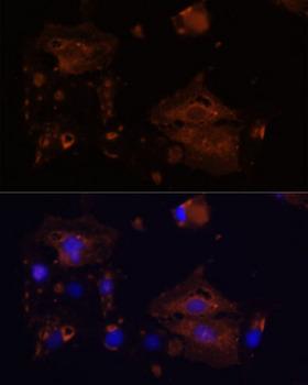 BAX Antibody - Immunofluorescence analysis of C6 cells using BAX antibody at dilution of 1:100. Blue: DAPI for nuclear staining.
