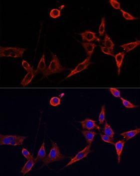 BAX Antibody - Immunofluorescence analysis of NIH/3T3 cells using BAX antibody at dilution of 1:100. Blue: DAPI for nuclear staining.