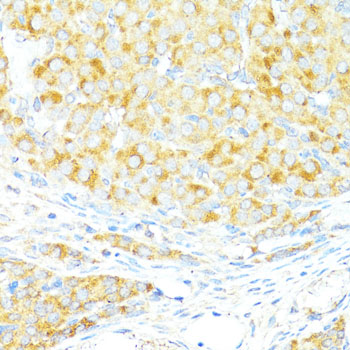 BAX Antibody - Immunohistochemistry of paraffin-embedded rat ovary using BAX antibody at dilution of 1:100 (40x lens).