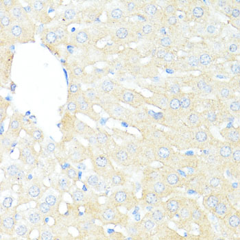BAX Antibody - Immunohistochemistry of paraffin-embedded mouse liver using BAX antibody at dilution of 1:100 (40x lens).
