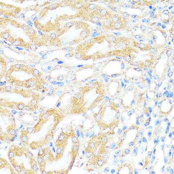 BAX Antibody - Immunohistochemistry of paraffin-embedded mouse kidney using BAX antibody at dilution of 1:100 (40x lens).