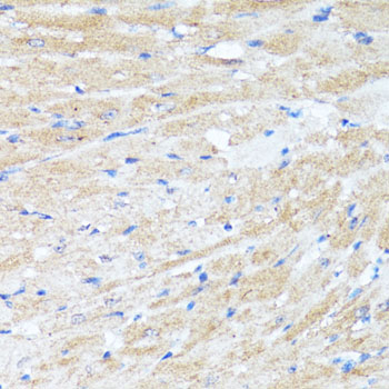 BAX Antibody - Immunohistochemistry of paraffin-embedded mouse heart using BAX antibody at dilution of 1:100 (40x lens).
