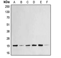 BAX Antibody - Western blot analysis of BAX expression in MCF7 (A); HeLa (B); A431 (C); HEK293T (D); Raw264.7 (E); rat brain (F) whole cell lysates.