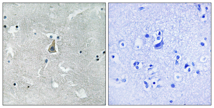 BAX Antibody - Immunohistochemistry analysis of paraffin-embedded human brain, using Bax (Phospho-Ser184) Antibody. The picture on the right is blocked with the phospho peptide.