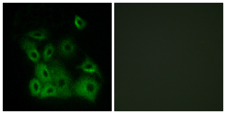 BAX Antibody - Immunofluorescence analysis of A549 cells, using Bax (Phospho-Thr167) Antibody. The picture on the right is blocked with the phospho peptide.