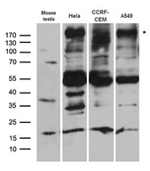 BAZ1A / ACF1 Antibody - Western blot analysis of extracts. (35ug) from different cell lines and tissues by using anti-BAZ1A rabbit polyclonal antibody.