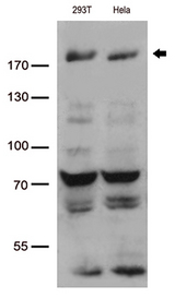 BAZ1B / WSTF Antibody - Western blot analysis of extracts. (35ug) from 2 cell lines lysates by using anti-BAZ1B monoclonal antibody. (1:500)