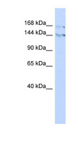 BAZ1B / WSTF Antibody - BAZ1B / WSTF antibody Western blot of 293T cell lysate. This image was taken for the unconjugated form of this product. Other forms have not been tested.