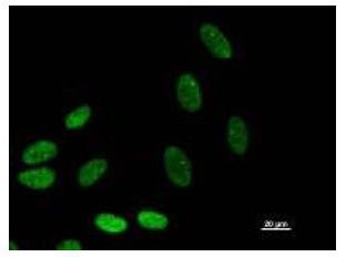 BAZ1B / WSTF Antibody - Immunofluorescent staining using BAZ1B antibody. Immunostaining analysis in HeLa cells. HeLa cells were fixed with 4% paraformaldehyde and permeabilized with 0.01% Triton-X100 in PBS. The cells were immunostained with anti-BAZ1B antibody.