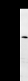 BAZ1B / WSTF Antibody - Detection of human BAZ1B by Western blot. Samples: Whole cell lysate (25 ug) from HeLa cells. Predicted molecular weight: 176 kDa