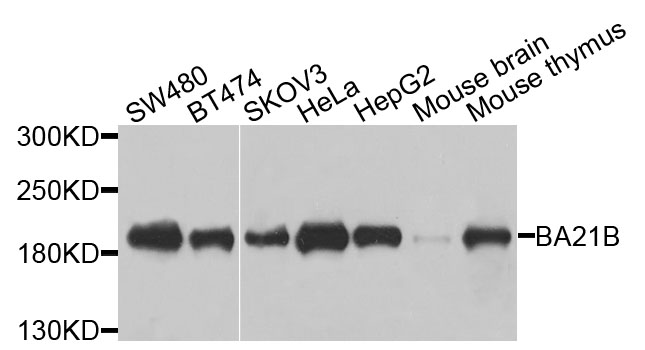 BAZ1B / WSTF Antibody - Western blot analysis of extracts of various cells.