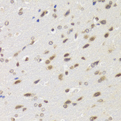 BAZ1B / WSTF Antibody - Immunohistochemistry of paraffin-embedded rat brain tissue.
