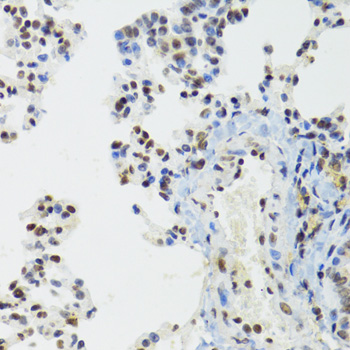 BAZ1B / WSTF Antibody - Immunohistochemistry of paraffin-embedded mouse lung tissue.