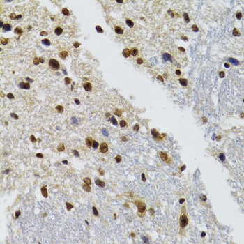 BAZ1B / WSTF Antibody - Immunohistochemistry of paraffin-embedded mouse brain tissue.