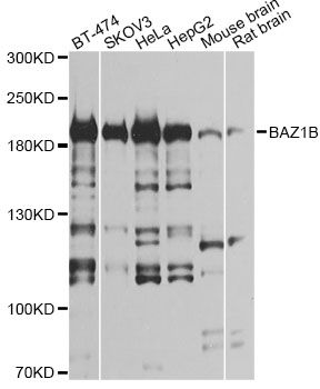 BAZ1B / WSTF Antibody - Western blot analysis of extracts of various cell lines, using BAZ1B antibody at 1:1000 dilution. The secondary antibody used was an HRP Goat Anti-Rabbit IgG (H+L) at 1:10000 dilution. Lysates were loaded 25ug per lane and 3% nonfat dry milk in TBST was used for blocking. An ECL Kit was used for detection and the exposure time was 5s.