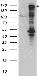 BAZ1B / WSTF Antibody - HEK293T cells were transfected with the pCMV6-ENTRY control. (Left lane) or pCMV6-ENTRY BAZ1B. (Right lane) cDNA for 48 hrs and lysed. Equivalent amounts of cell lysates. (5 ug per lane) were separated by SDS-PAGE and immunoblotted with anti-BAZ1B rabbit polyclonal antibody.