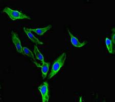 BAZ2A / TIP5 Antibody - Immunofluorescent analysis of Hela cells diluted at 1:100 and Alexa Fluor 488-congugated AffiniPure Goat Anti-Rabbit IgG(H+L)