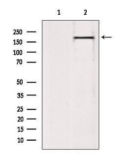 BAZ2A / TIP5 Antibody - Western blot analysis of extracts of 293 cells using BAZ2A antibody. Lane 1 was treated with the blocking peptide.