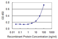 BAZ2B Antibody - Detection limit for recombinant GST tagged BAZ2B is 0.3 ng/ml as a capture antibody.