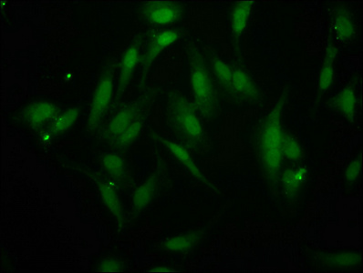 BAZ2B Antibody - Immunofluorescence staining of Hela cells at a dilution of 1:266, counter-stained with DAPI. The cells were fixed in 4% formaldehyde, permeabilized using 0.2% Triton X-100 and blocked in 10% normal Goat Serum. The cells were then incubated with the antibody overnight at 4 °C.The secondary antibody was Alexa Fluor 488-congugated AffiniPure Goat Anti-Rabbit IgG (H+L) .