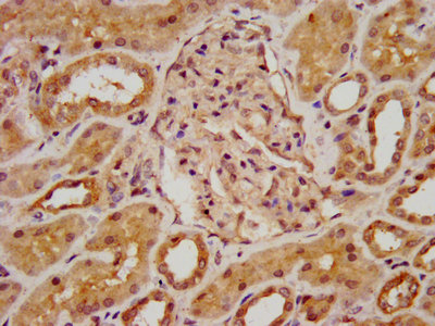 BAZ2B Antibody - IHC image of BAZ2B Antibody diluted at 1:800 and staining in paraffin-embedded human kidney tissue performed on a Leica BondTM system. After dewaxing and hydration, antigen retrieval was mediated by high pressure in a citrate buffer (pH 6.0). Section was blocked with 10% normal goat serum 30min at RT. Then primary antibody (1% BSA) was incubated at 4°C overnight. The primary is detected by a biotinylated secondary antibody and visualized using an HRP conjugated SP system.