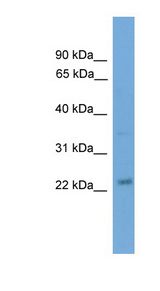 BBC3 / PUMA Antibody - BBC3 / PUMA antibody Western blot of Placenta lysate. This image was taken for the unconjugated form of this product. Other forms have not been tested.
